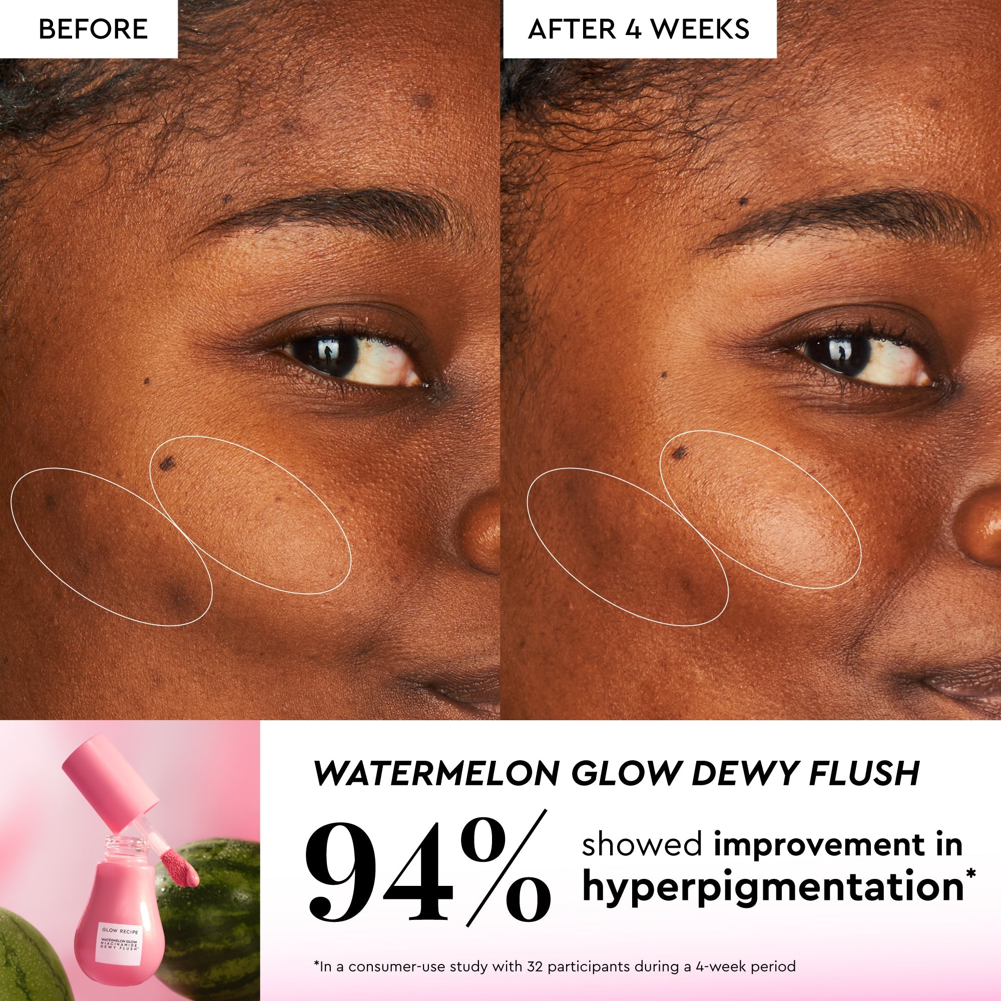 Watermelon Glow Best-Sellers Kit - product image 7