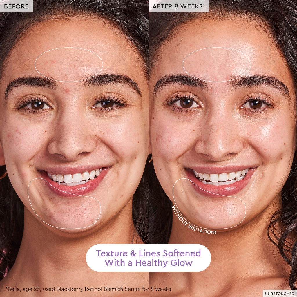 Blackberry Retinol Blemish Serum - product image 6