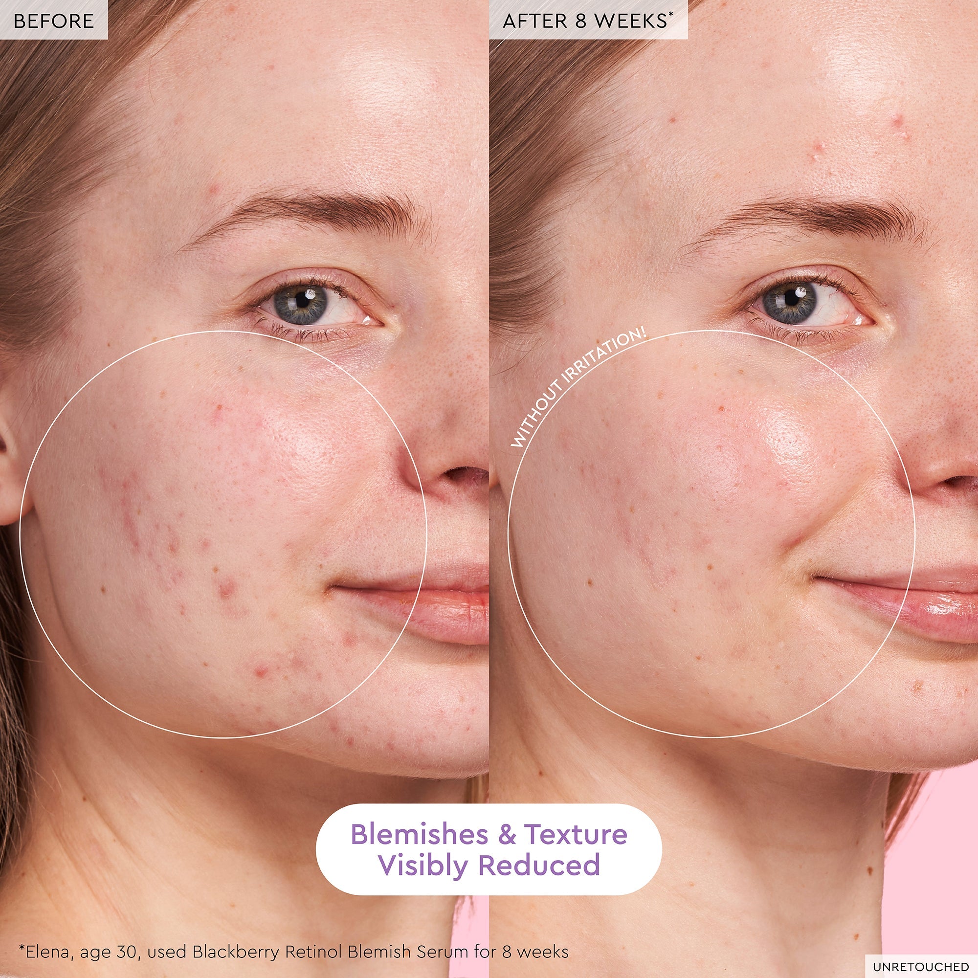 Blackberry Retinol Blemish Serum - product image 3