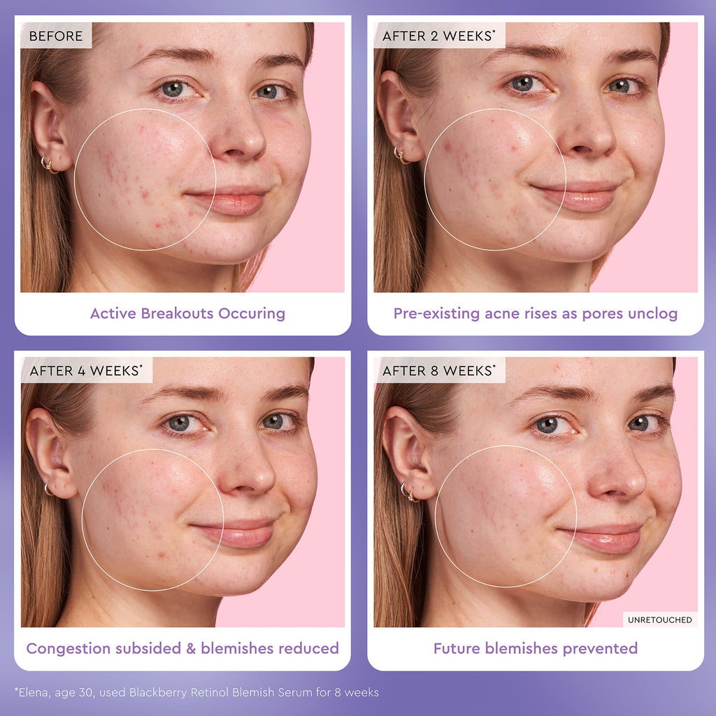 Blackberry Retinol Blemish Serum - product image 4