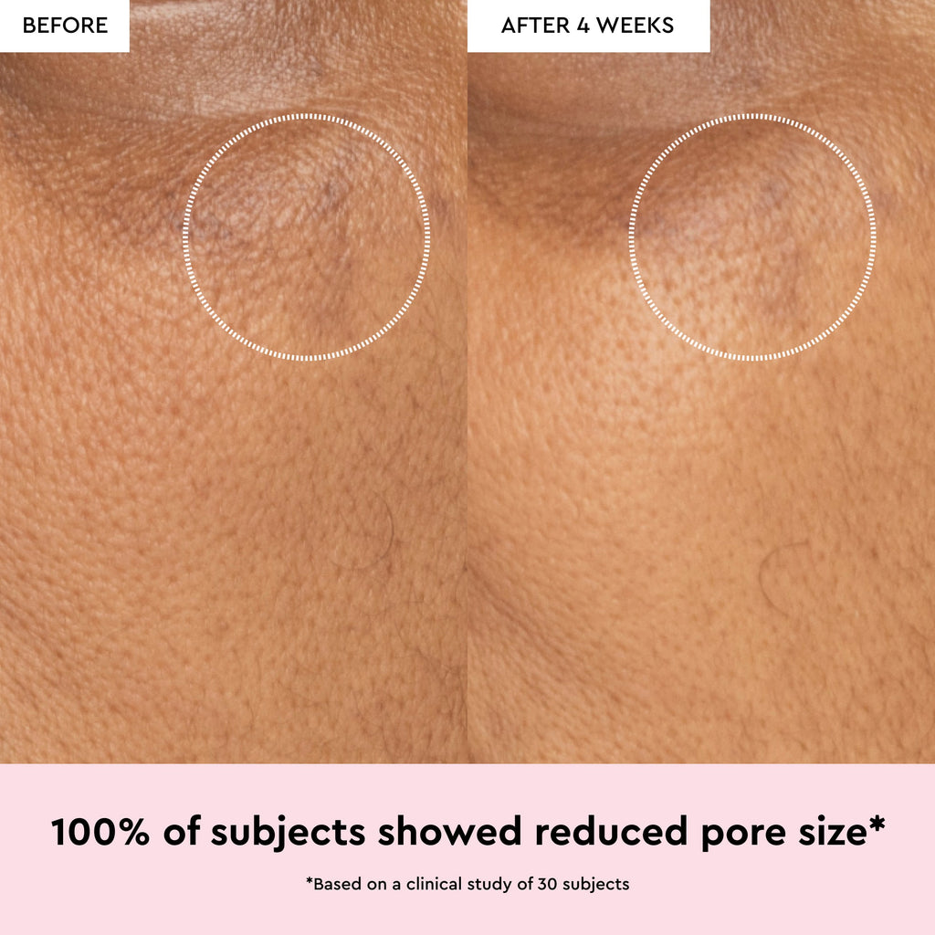 Watermelon Glow Niacinamide Dew Drops - product image 4