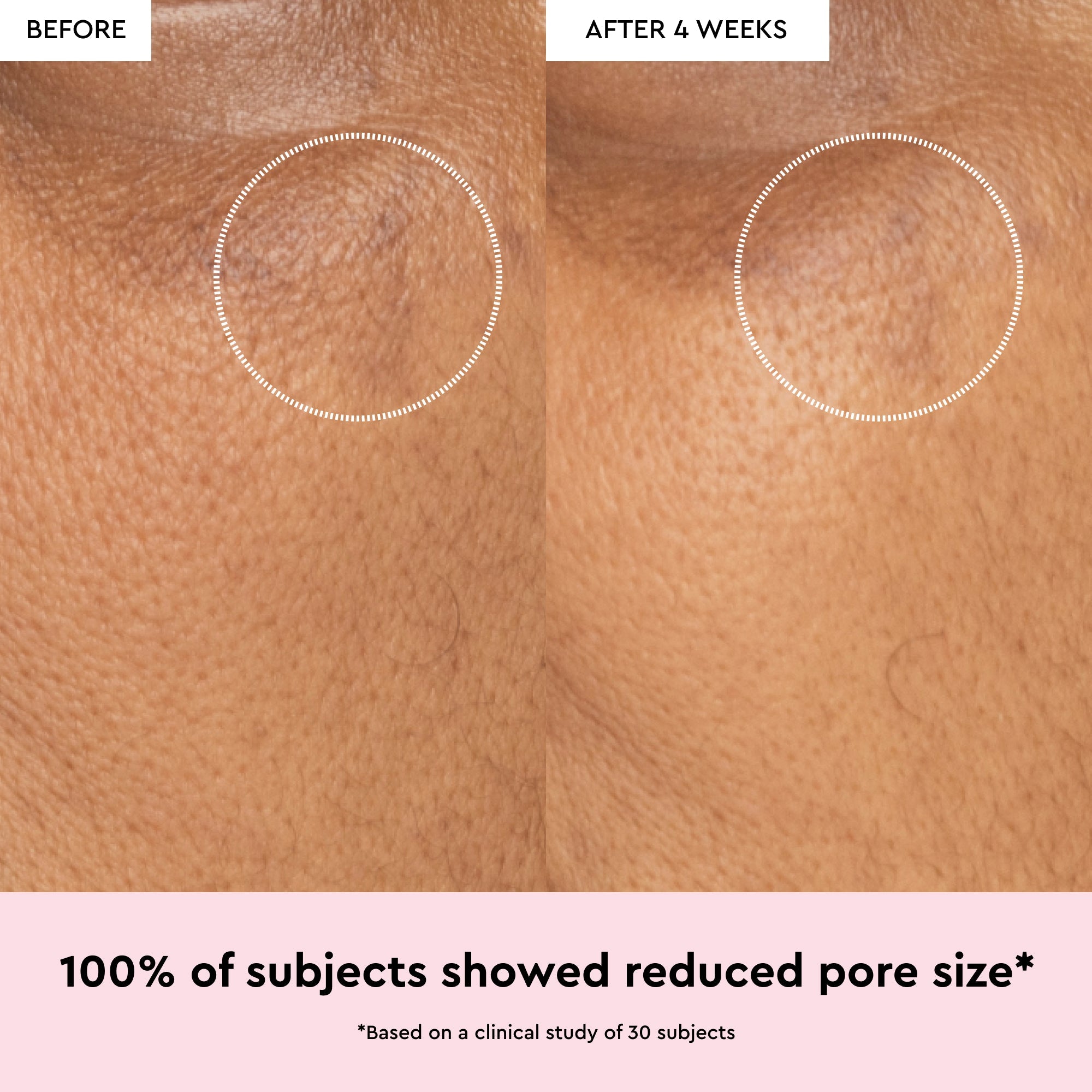 Watermelon Glow Niacinamide Dew Drops - product image 4