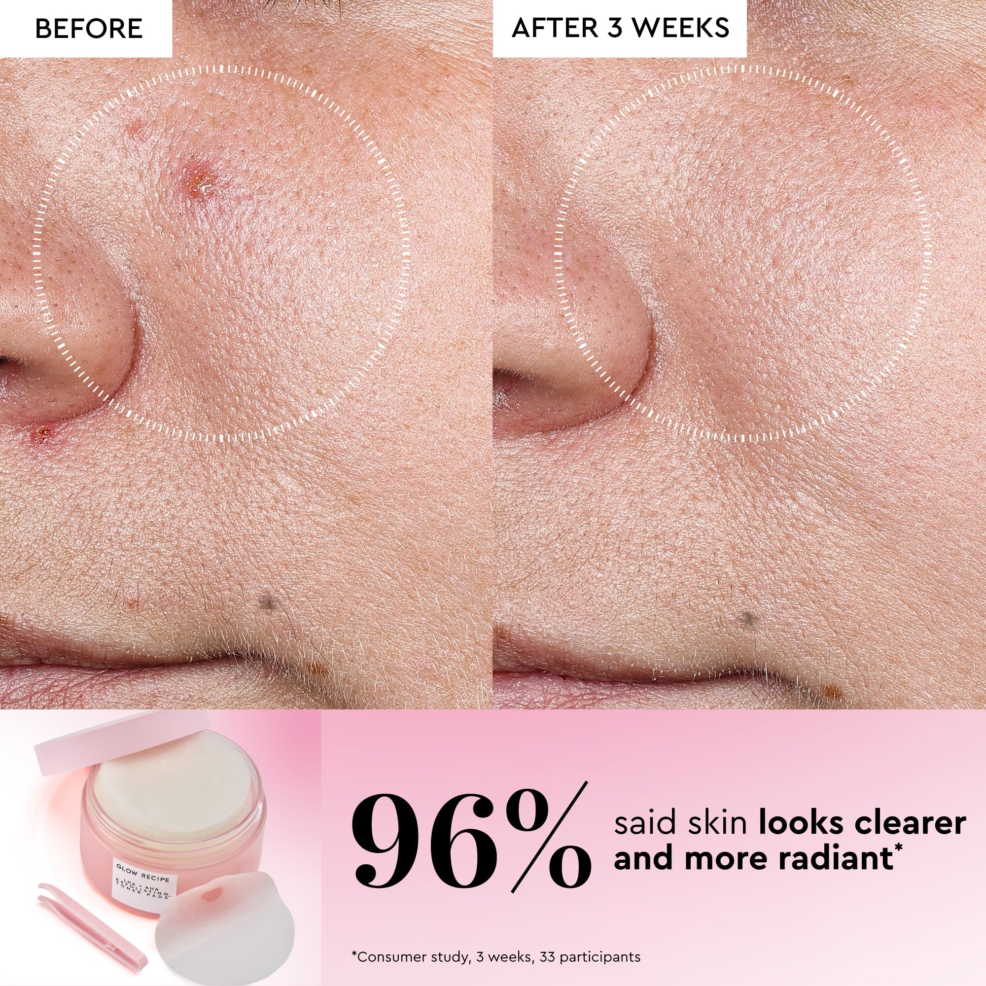 Korean Toner Pad Collection Trial Set - product image 4